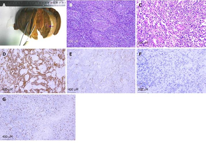 https://cdn.ncbi.nlm.nih.gov/pmc/blobs/44df/6937438/6773af2bb693/WJGO-11-1231-g003.jpg