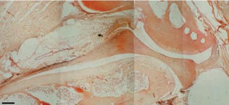https://cdn.ncbi.nlm.nih.gov/pmc/blobs/44e1/10521880/7d99fbc21cf5/ACTA-87-282-g001.jpg