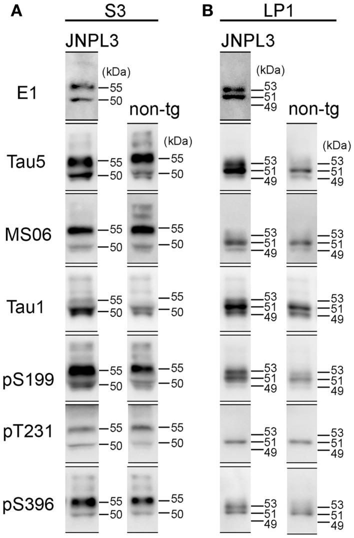 https://cdn.ncbi.nlm.nih.gov/pmc/blobs/44e7/3949102/b21b2cfb2138/fneur-05-00026-g004.jpg