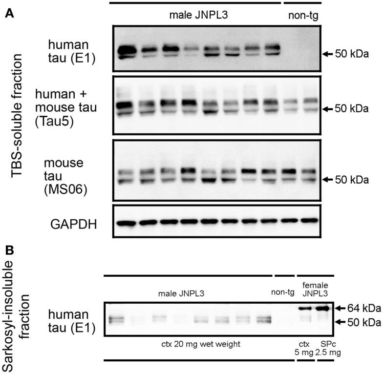 https://cdn.ncbi.nlm.nih.gov/pmc/blobs/44e7/3949102/c5f91ff3bfc7/fneur-05-00026-g001.jpg