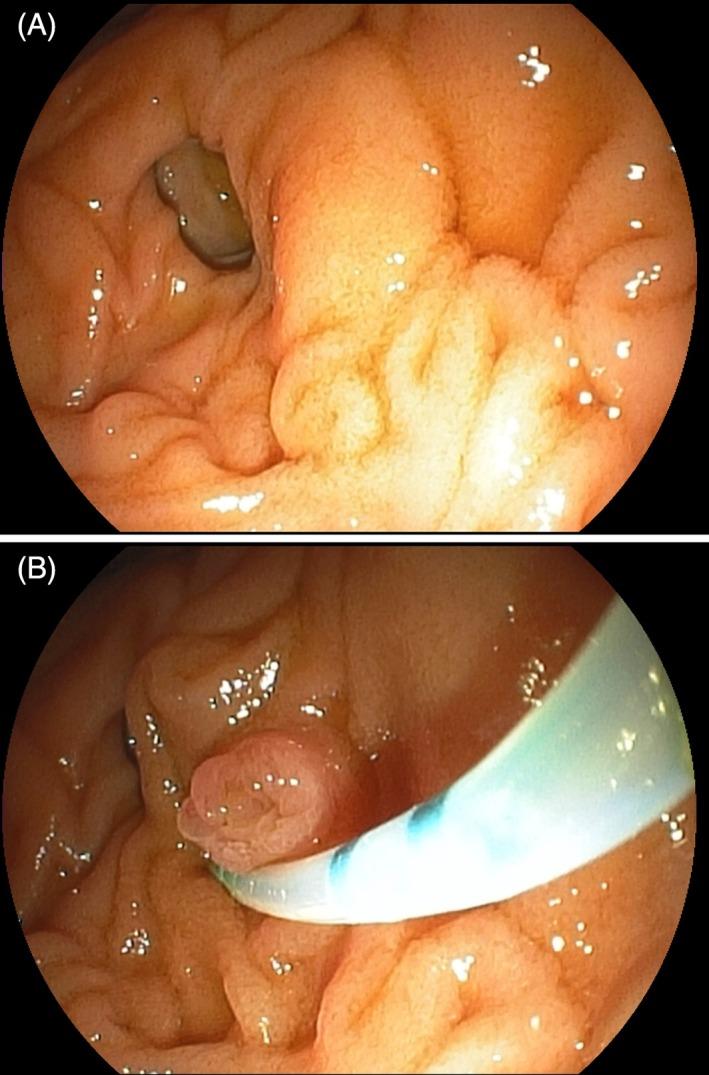 https://cdn.ncbi.nlm.nih.gov/pmc/blobs/44e8/6891030/4cc56c4ae5d4/JGH3-3-534-g001.jpg