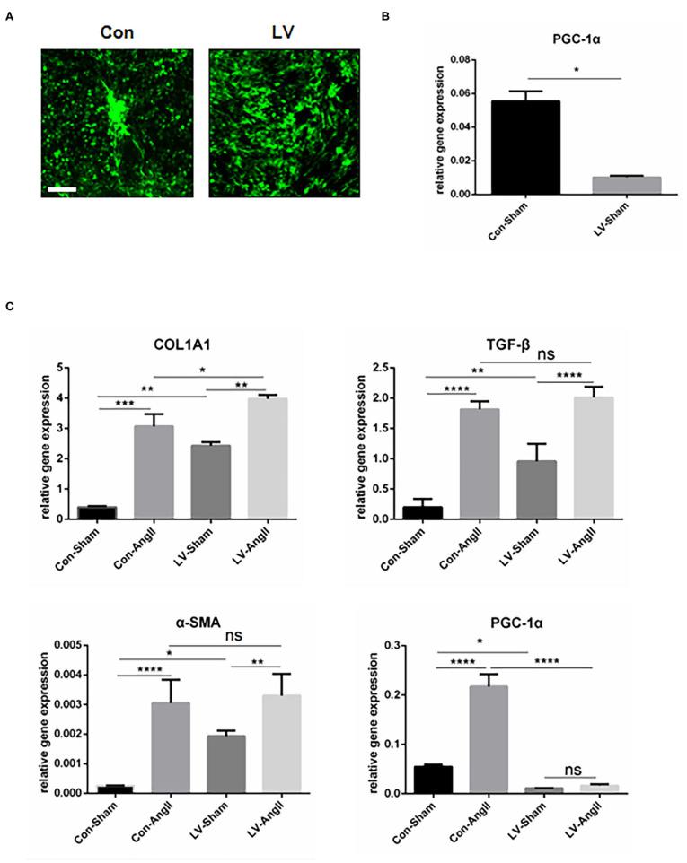 https://cdn.ncbi.nlm.nih.gov/pmc/blobs/44f8/8242582/0716f19d64e5/fcvm-08-664626-g0005.jpg