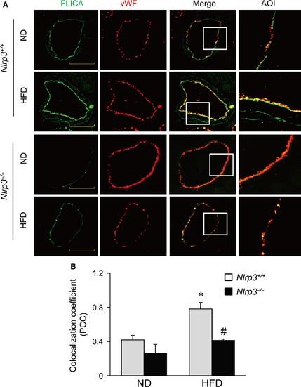 https://cdn.ncbi.nlm.nih.gov/pmc/blobs/44fb/4687695/103f5841a4c0/JCMM-19-2715-g006.jpg