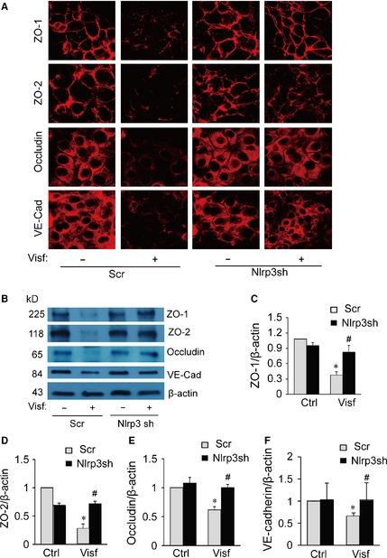 https://cdn.ncbi.nlm.nih.gov/pmc/blobs/44fb/4687695/16dba2cf1844/JCMM-19-2715-g001.jpg