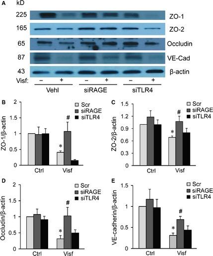 https://cdn.ncbi.nlm.nih.gov/pmc/blobs/44fb/4687695/938bc4de13ca/JCMM-19-2715-g004.jpg