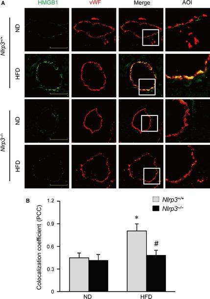 https://cdn.ncbi.nlm.nih.gov/pmc/blobs/44fb/4687695/cc4e53cd7f41/JCMM-19-2715-g007.jpg