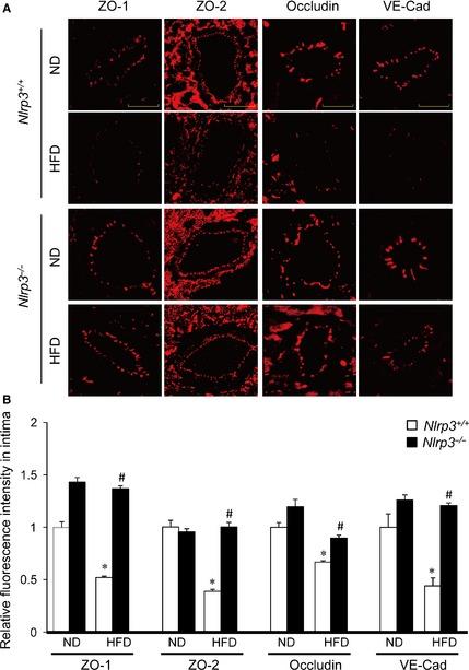 https://cdn.ncbi.nlm.nih.gov/pmc/blobs/44fb/4687695/f8472ac0716e/JCMM-19-2715-g005.jpg