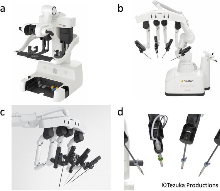 https://cdn.ncbi.nlm.nih.gov/pmc/blobs/44fd/9562055/1850f5712e1e/423_2022_2710_Fig1_HTML.jpg