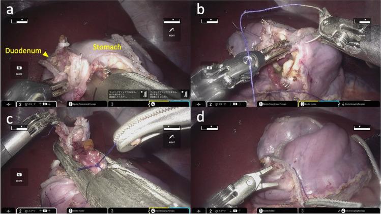 https://cdn.ncbi.nlm.nih.gov/pmc/blobs/44fd/9562055/8c402efc8ceb/423_2022_2710_Fig7_HTML.jpg