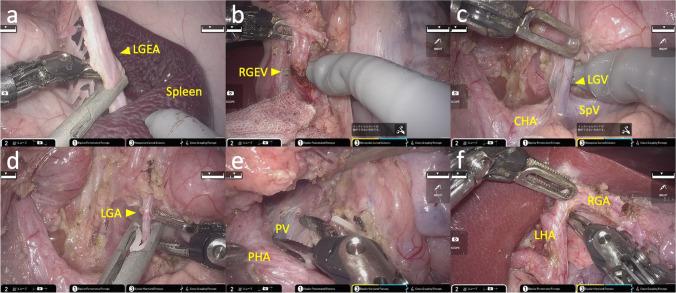 https://cdn.ncbi.nlm.nih.gov/pmc/blobs/44fd/9562055/9dbdc162e10a/423_2022_2710_Fig6_HTML.jpg