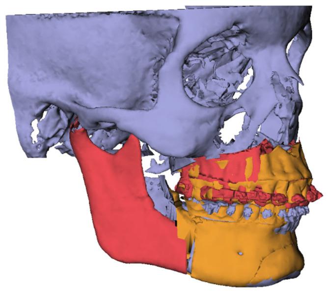 https://cdn.ncbi.nlm.nih.gov/pmc/blobs/4501/12347082/c3ebf3c8cd3d/jcm-14-05270-g005.jpg