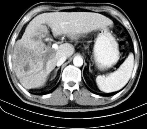 https://cdn.ncbi.nlm.nih.gov/pmc/blobs/4501/2769314/6ba03e230be5/1757-1626-0002-0000006789-001.jpg