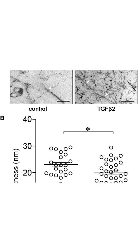 https://cdn.ncbi.nlm.nih.gov/pmc/blobs/4509/4297071/50160edf3690/10.1177_1947603510361238-fig3.jpg