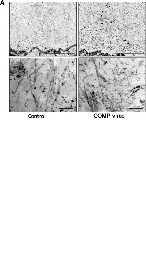 https://cdn.ncbi.nlm.nih.gov/pmc/blobs/4509/4297071/6dfa346bea45/10.1177_1947603510361238-fig7.jpg