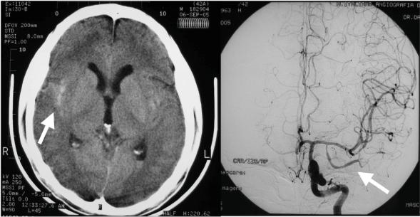 https://cdn.ncbi.nlm.nih.gov/pmc/blobs/450b/3139252/68a47e45ec54/TOAIDJ-5-62_F1.jpg