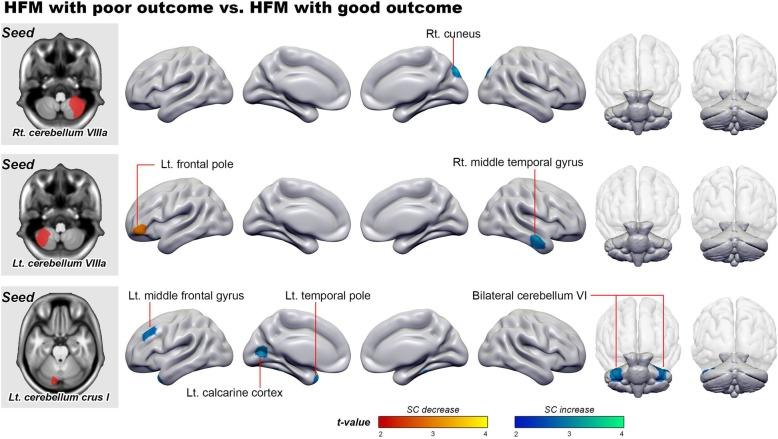 https://cdn.ncbi.nlm.nih.gov/pmc/blobs/4514/7081533/e3de8b97f778/10194_2020_1096_Fig2_HTML.jpg