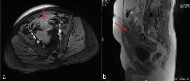 https://cdn.ncbi.nlm.nih.gov/pmc/blobs/451e/3263229/9f0b819e0404/IJU-27-545-g001.jpg