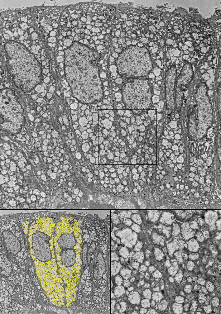 https://cdn.ncbi.nlm.nih.gov/pmc/blobs/451f/8822387/1870cc5a7e61/CJP2-8-155-g001.jpg