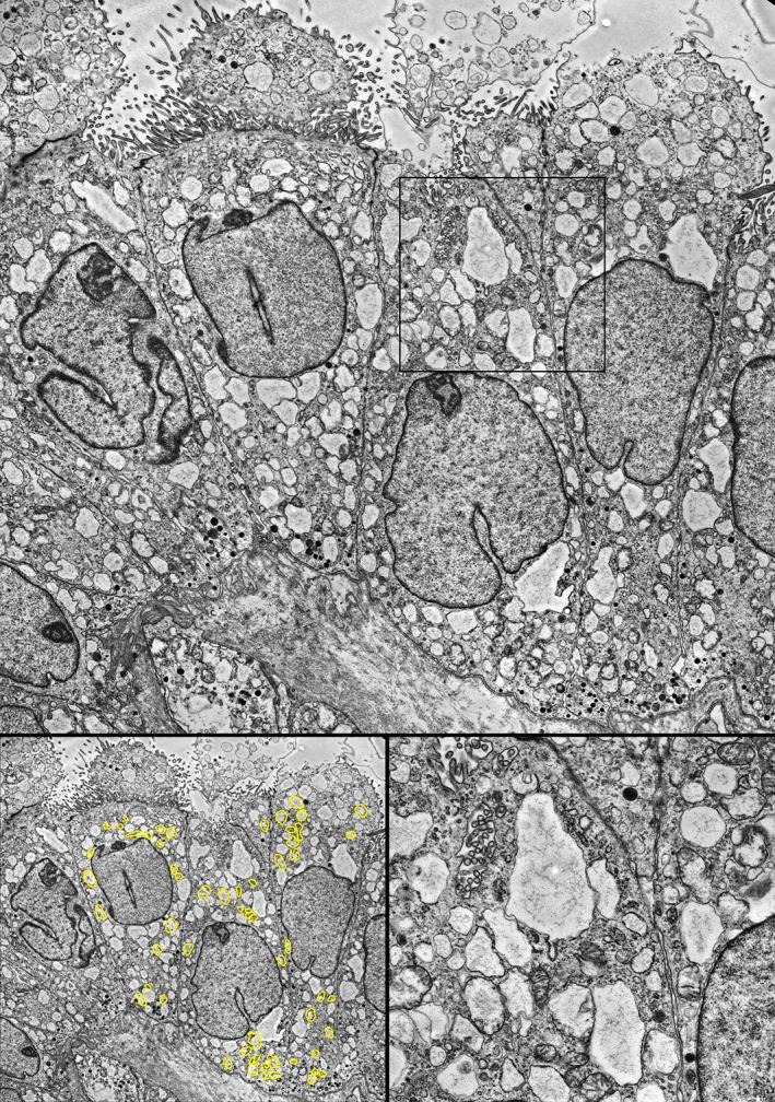 https://cdn.ncbi.nlm.nih.gov/pmc/blobs/451f/8822387/38d4ac5e83e3/CJP2-8-155-g006.jpg