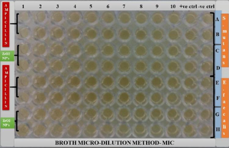 https://cdn.ncbi.nlm.nih.gov/pmc/blobs/4525/11711109/7045cc45f7ba/cureus-0016-00000075421-i03.jpg