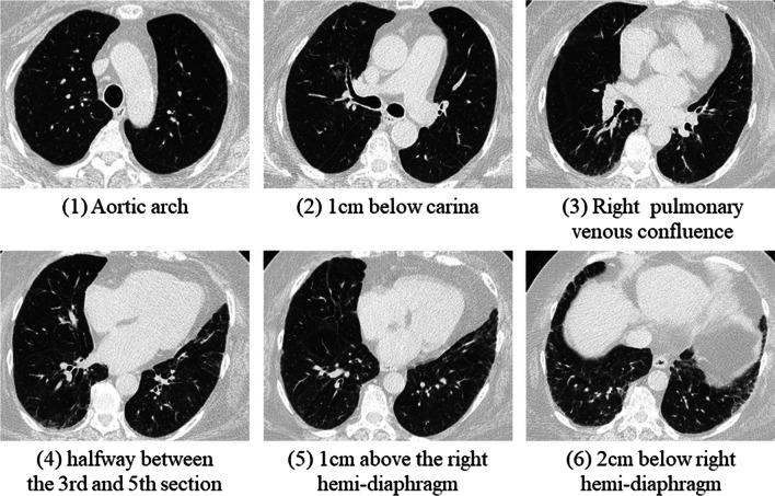https://cdn.ncbi.nlm.nih.gov/pmc/blobs/4529/9034618/80716b2cd3b1/12880_2022_803_Fig1_HTML.jpg