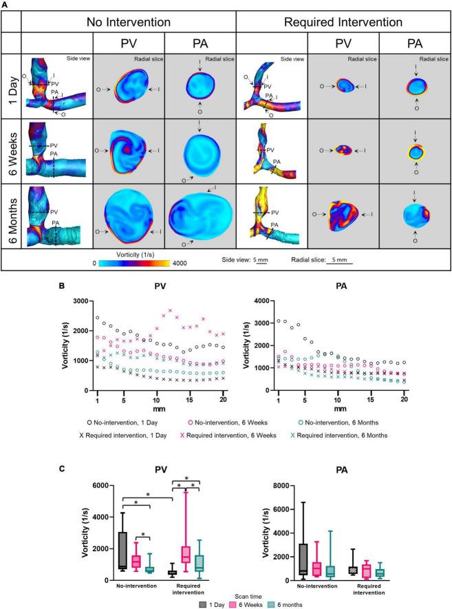 https://cdn.ncbi.nlm.nih.gov/pmc/blobs/452c/9669082/12d6a045213b/fcvm-09-1001267-g006.jpg