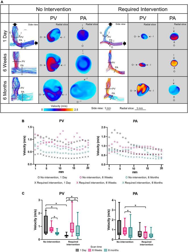 https://cdn.ncbi.nlm.nih.gov/pmc/blobs/452c/9669082/49d395939cee/fcvm-09-1001267-g003.jpg