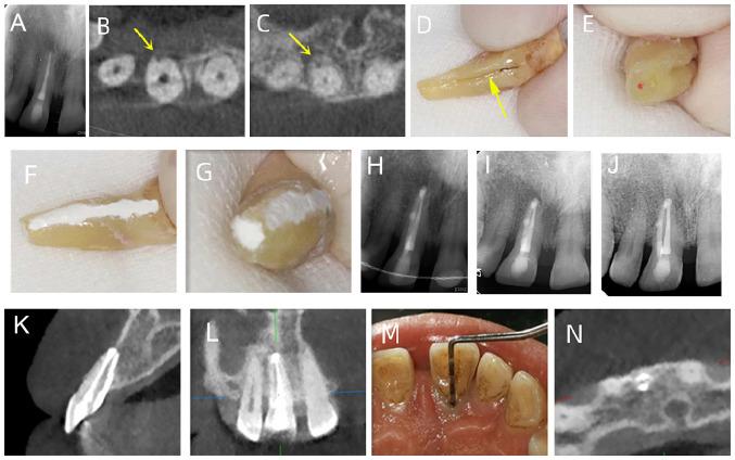https://cdn.ncbi.nlm.nih.gov/pmc/blobs/4533/10928843/bb2b63689cb1/etm-27-04-12426-g04.jpg