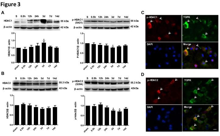 https://cdn.ncbi.nlm.nih.gov/pmc/blobs/4535/5963345/4d4c40b751b9/ad-9-2-235-g3.jpg