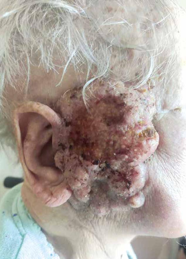 https://cdn.ncbi.nlm.nih.gov/pmc/blobs/4537/10546968/1d8c584c4804/WO-27-51081-g003.jpg