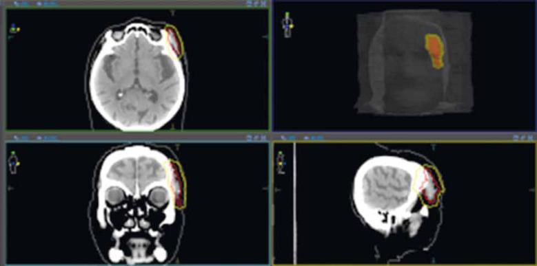 https://cdn.ncbi.nlm.nih.gov/pmc/blobs/4537/10546968/2354dc1670c1/WO-27-51081-g011.jpg