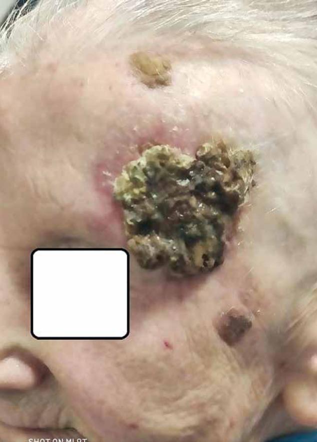 https://cdn.ncbi.nlm.nih.gov/pmc/blobs/4537/10546968/582af2d2ae1b/WO-27-51081-g010.jpg