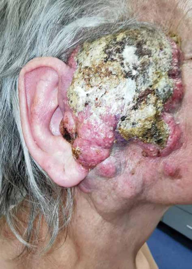 https://cdn.ncbi.nlm.nih.gov/pmc/blobs/4537/10546968/ac32ed92541b/WO-27-51081-g001.jpg