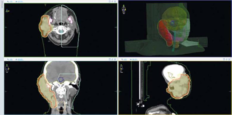 https://cdn.ncbi.nlm.nih.gov/pmc/blobs/4537/10546968/d9635cf3a2a5/WO-27-51081-g002.jpg