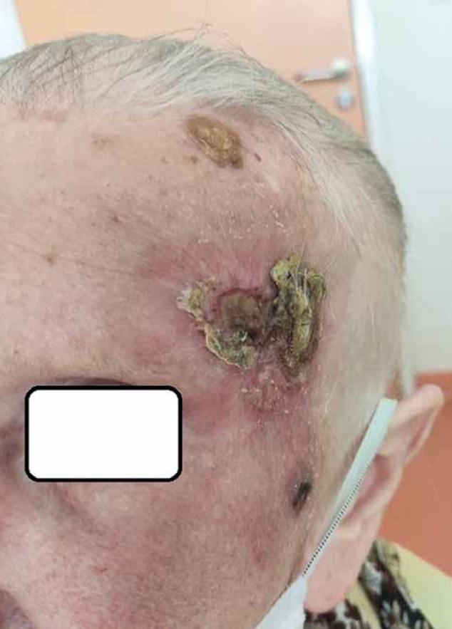 https://cdn.ncbi.nlm.nih.gov/pmc/blobs/4537/10546968/e5a2d945de8e/WO-27-51081-g012.jpg
