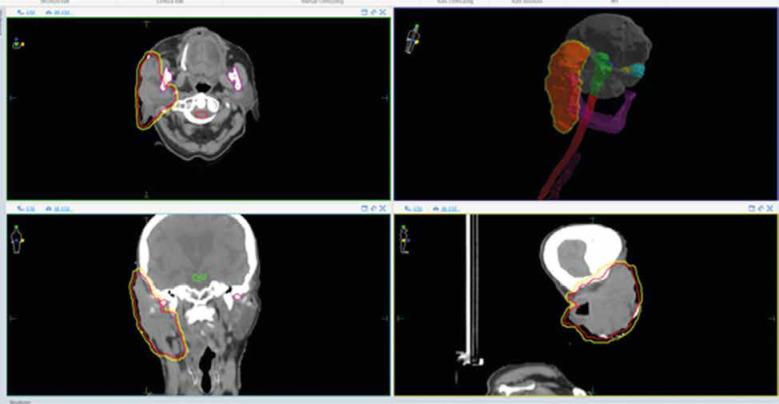 https://cdn.ncbi.nlm.nih.gov/pmc/blobs/4537/10546968/f07a670dbb23/WO-27-51081-g004.jpg