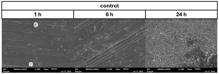 https://cdn.ncbi.nlm.nih.gov/pmc/blobs/4538/11768219/840eed2fce22/pathogens-14-00057-g004.jpg