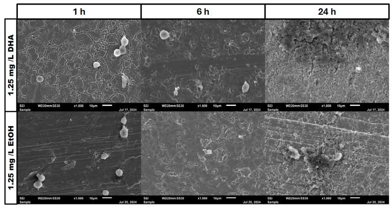 https://cdn.ncbi.nlm.nih.gov/pmc/blobs/4538/11768219/e8f4e6ec5dd4/pathogens-14-00057-g005.jpg