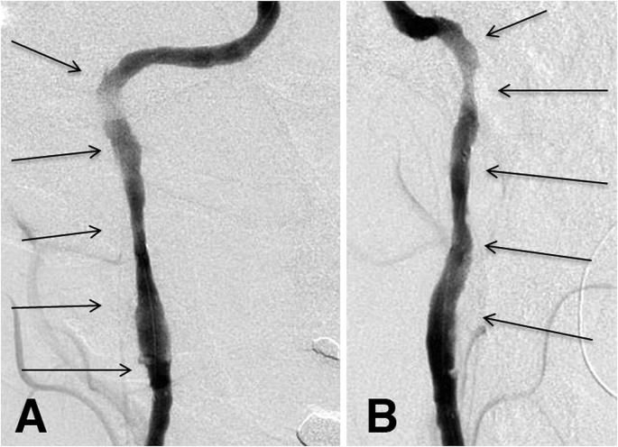 https://cdn.ncbi.nlm.nih.gov/pmc/blobs/453b/5722172/94e81cb7a664/gr3.jpg