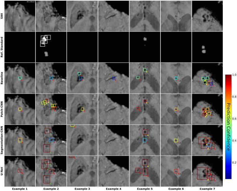 https://cdn.ncbi.nlm.nih.gov/pmc/blobs/453b/9127224/040e06e38ad5/gr6.jpg