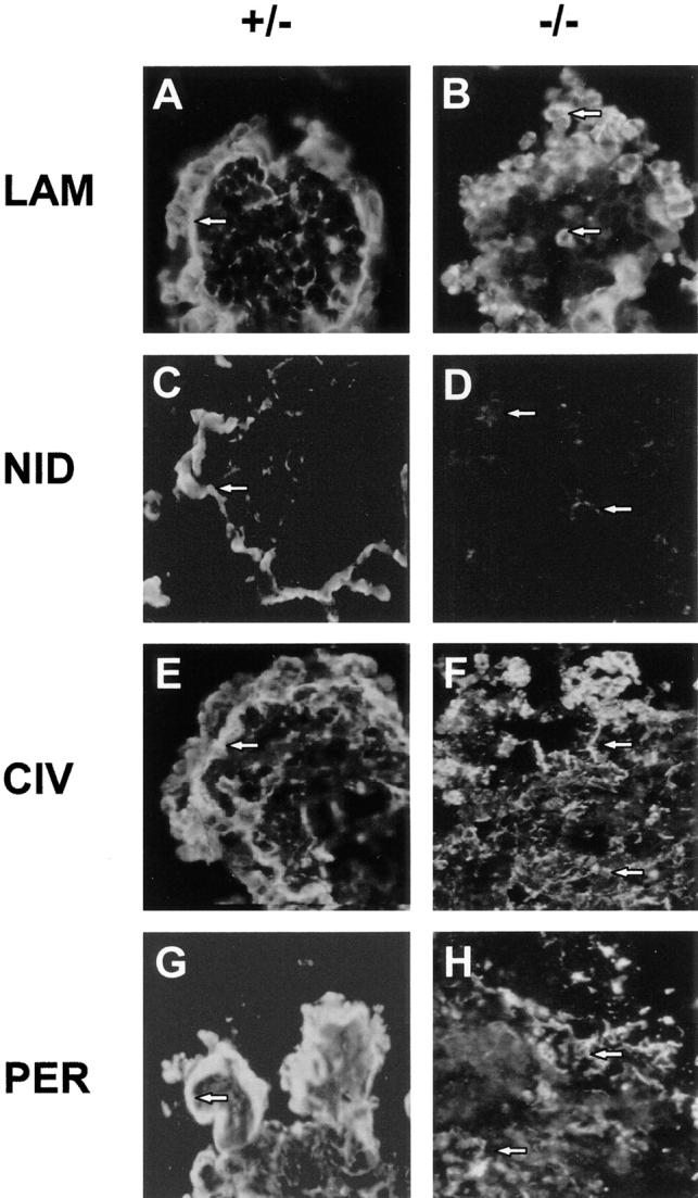 https://cdn.ncbi.nlm.nih.gov/pmc/blobs/453d/2148127/b7f8900f417e/JCB9807138.f7.jpg