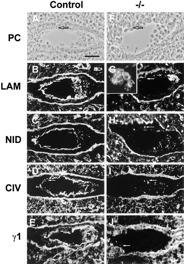 https://cdn.ncbi.nlm.nih.gov/pmc/blobs/453d/2148127/f1c8b0617d4e/JCB9807138.f4.jpg