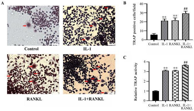 https://cdn.ncbi.nlm.nih.gov/pmc/blobs/453e/8097200/2d99e4eb12f0/etm-21-06-10072-g01.jpg