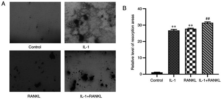 https://cdn.ncbi.nlm.nih.gov/pmc/blobs/453e/8097200/60991f70a5e3/etm-21-06-10072-g03.jpg