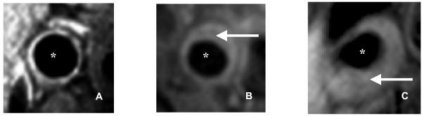 https://cdn.ncbi.nlm.nih.gov/pmc/blobs/4540/2680849/91fb079aeb11/1532-429X-11-10-2.jpg