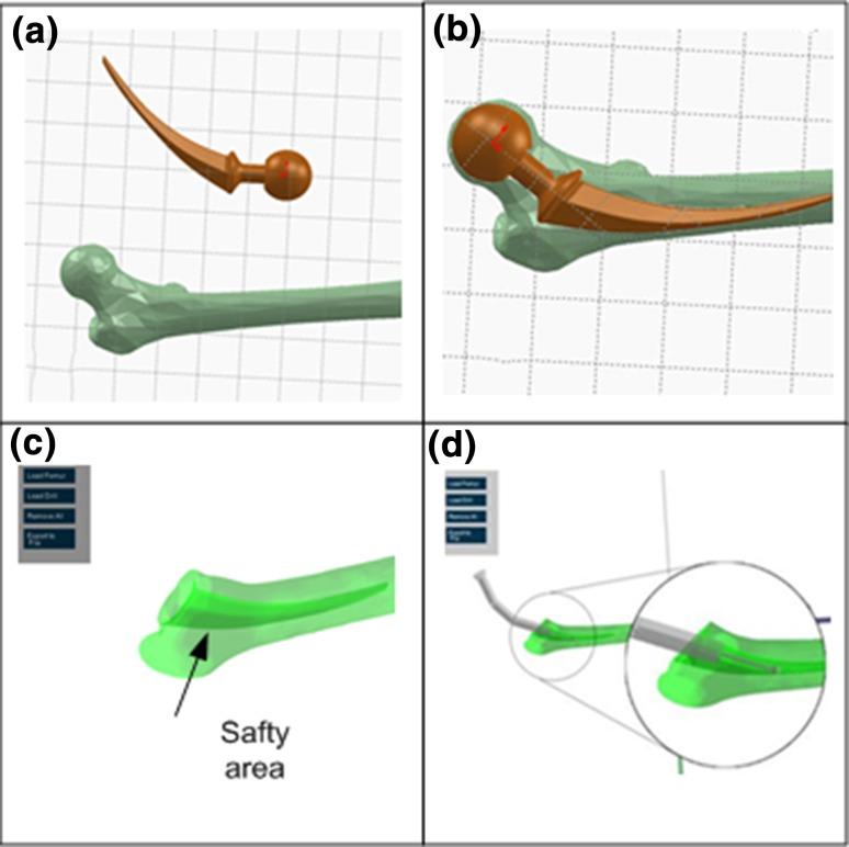 https://cdn.ncbi.nlm.nih.gov/pmc/blobs/454a/5809567/5c43b7ef7a9b/10439_2017_1959_Fig5_HTML.jpg