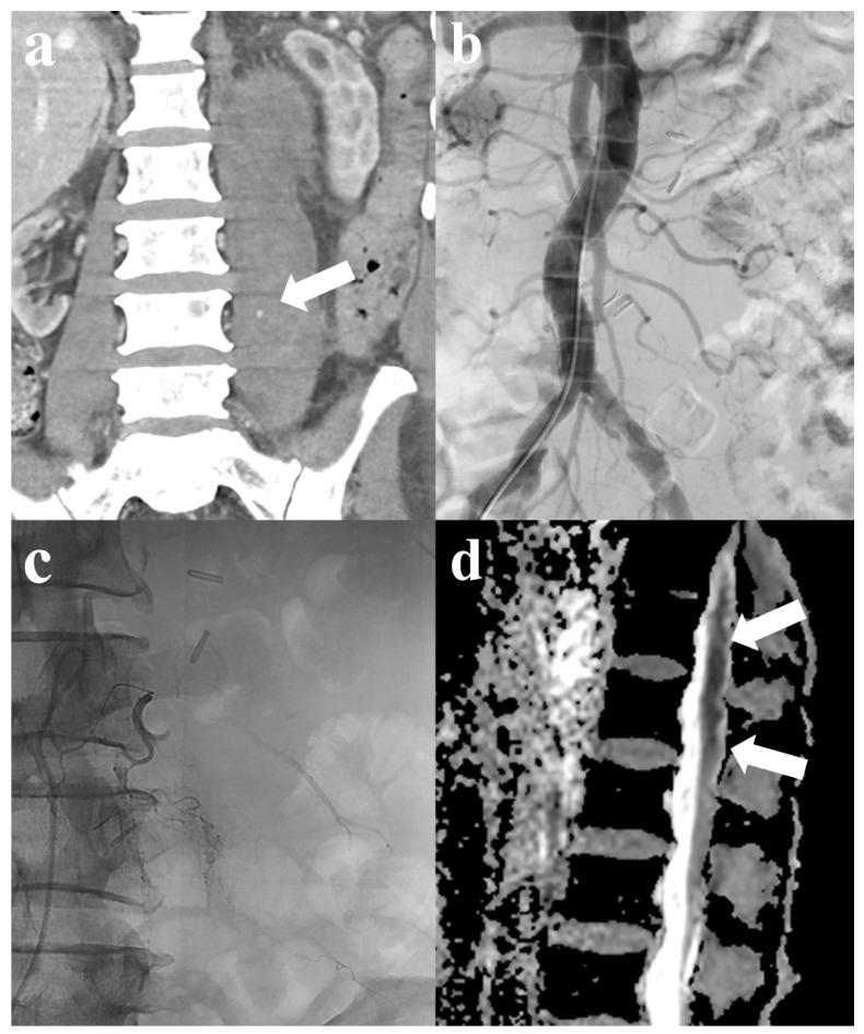 https://cdn.ncbi.nlm.nih.gov/pmc/blobs/454c/11172624/d5fac124cbba/jcm-13-03317-g002.jpg