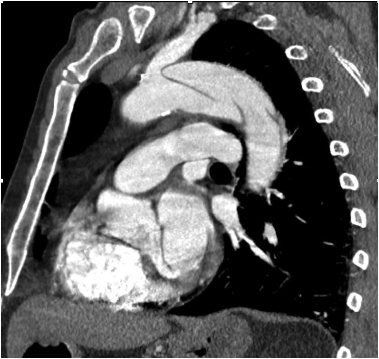 https://cdn.ncbi.nlm.nih.gov/pmc/blobs/454d/7876933/b46111856fa9/gr1.jpg