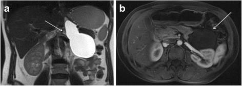 https://cdn.ncbi.nlm.nih.gov/pmc/blobs/4551/4335415/487a67772bc3/12957_2015_490_Fig1_HTML.jpg
