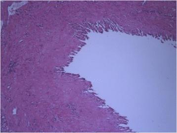 https://cdn.ncbi.nlm.nih.gov/pmc/blobs/4551/4335415/9ee8ee4c13af/12957_2015_490_Fig3_HTML.jpg